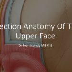 Injection Anatomy Of The Upper Face