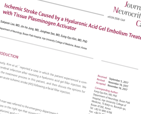 Ischemic Stroke Caused by a Hyaluronic Acid Gel Embolism Treated with Tissue Plasminogen Activator