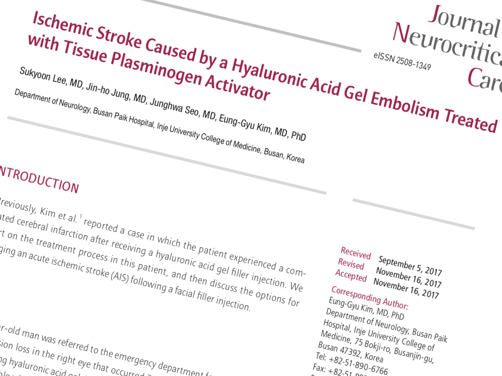 Ischemic Stroke Caused by a Hyaluronic Acid Gel Embolism Treated with Tissue Plasminogen Activator