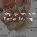 Retaining Facial Ligaments